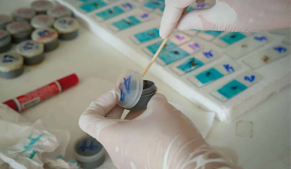 Stool Testing: Microbial Markers and Their Role in IBS Management 3 Benefits of Stool Testing. Brisbane Livewell Clinic.